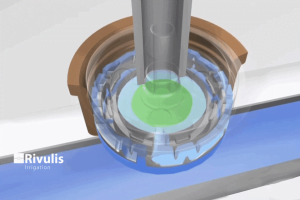 nguyen-nhan-va-cach-xu-ly-khi-dau-tuoi-nho-giot-tac-nghen